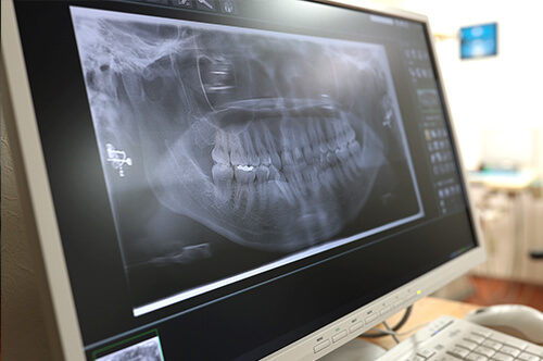 相模原市中央区の歯医者、アオキ歯科クリニック治療設備等