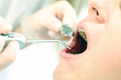 相模原市中央区の歯医者アオキ歯科クリニック、虫歯治療・歯周病治療イメージ